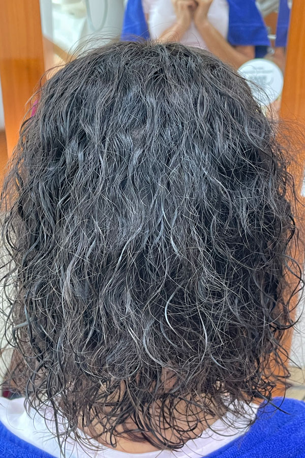 Nachher-Foto mit dem Tritec-Hairsystem