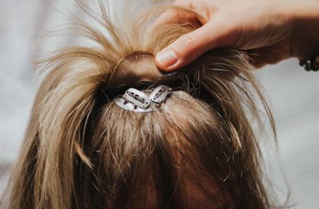 Befestigung des Tritec Haarersatzes